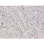 Immunohistochemistry - ALDH1A1 Antibody from Signalway Antibody (32441) - Antibodies.com