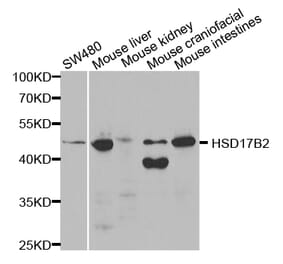 Western blot - HSD17B2 Antibody from Signalway Antibody (32534) - Antibodies.com