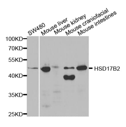 Western blot - HSD17B2 Antibody from Signalway Antibody (32534) - Antibodies.com