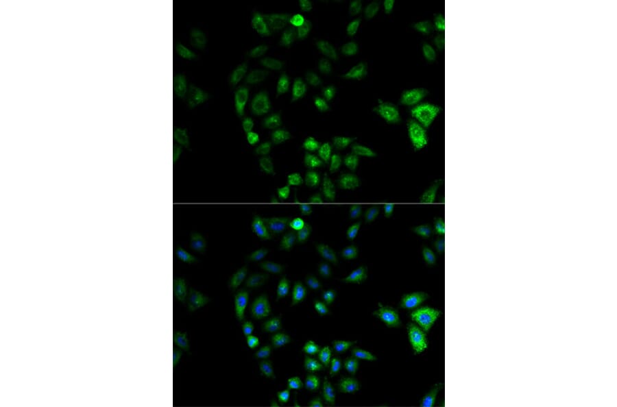 Immunofluorescence - HSD17B2 Antibody from Signalway Antibody (32534) - Antibodies.com