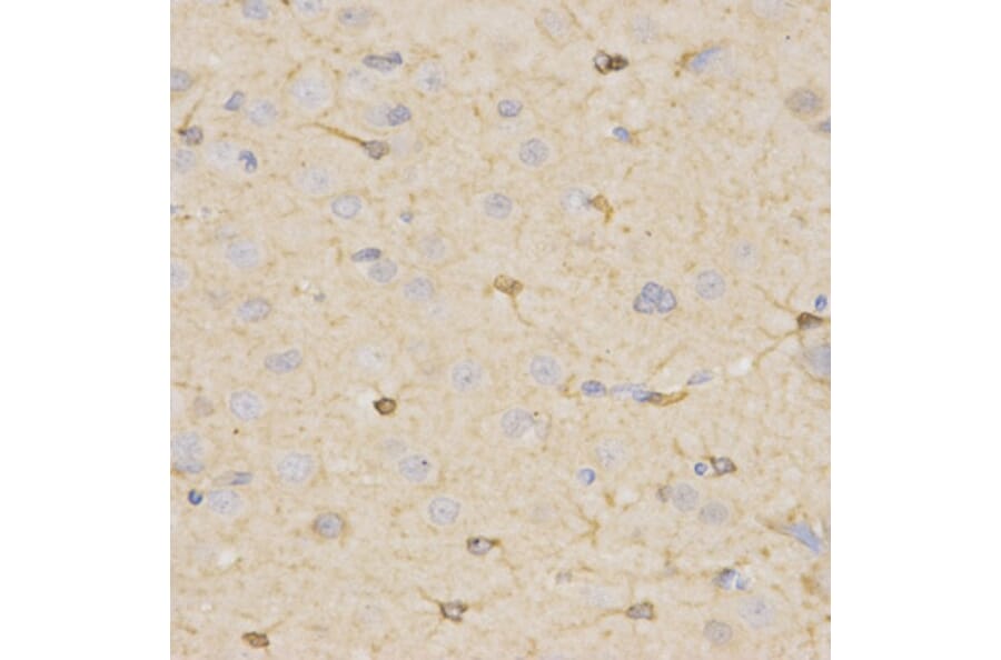 Immunohistochemistry - HSD17B2 Antibody from Signalway Antibody (32534) - Antibodies.com
