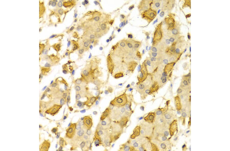 Immunohistochemistry - HSD17B2 Antibody from Signalway Antibody (32534) - Antibodies.com