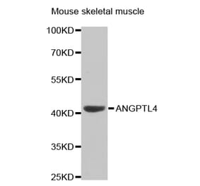 Western blot - ANGPTL4 Antibody from Signalway Antibody (32550) - Antibodies.com