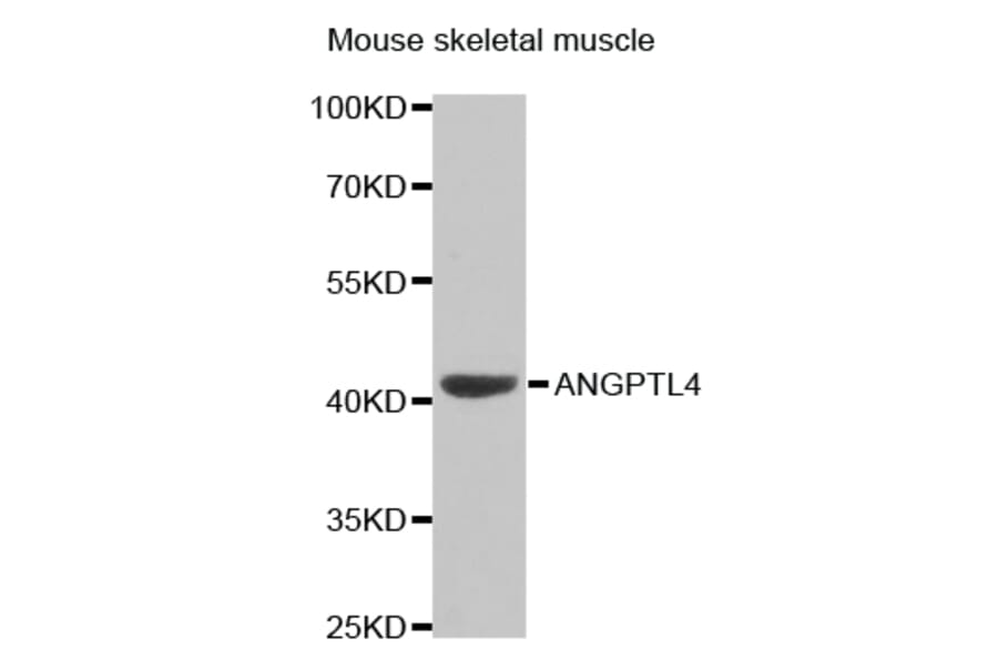 Western blot - ANGPTL4 Antibody from Signalway Antibody (32550) - Antibodies.com