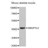 Western blot - ANGPTL4 Antibody from Signalway Antibody (32550) - Antibodies.com