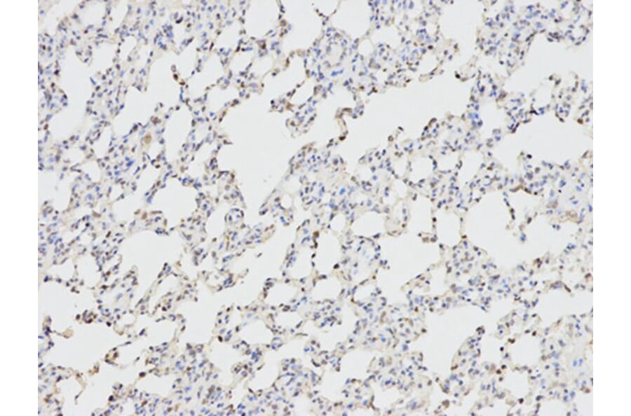 Immunohistochemistry - ANGPTL4 Antibody from Signalway Antibody (32550) - Antibodies.com