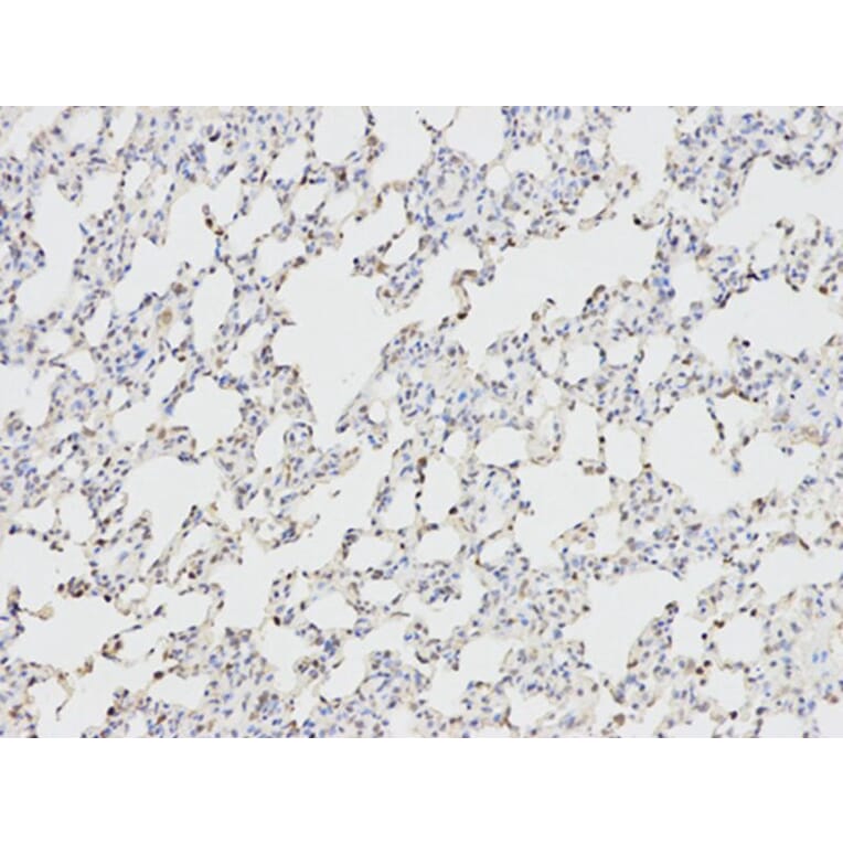 Immunohistochemistry - ANGPTL4 Antibody from Signalway Antibody (32550) - Antibodies.com