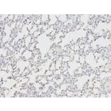 Immunohistochemistry - ANGPTL4 Antibody from Signalway Antibody (32550) - Antibodies.com