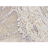 Immunohistochemistry - ANGPTL4 Antibody from Signalway Antibody (32550) - Antibodies.com