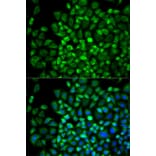 Immunofluorescence - ANGPTL4 Antibody from Signalway Antibody (32550) - Antibodies.com