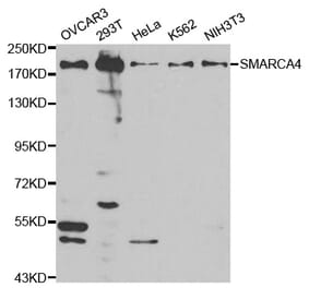 Western blot - SMARCA4 Antibody from Signalway Antibody (32608) - Antibodies.com
