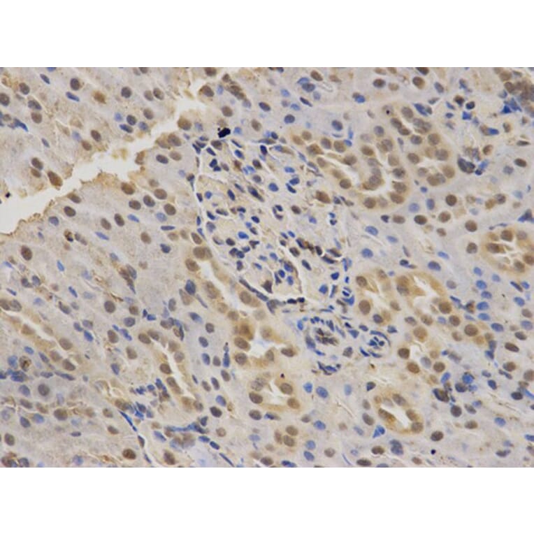 Immunohistochemistry - SMARCA4 Antibody from Signalway Antibody (32608) - Antibodies.com