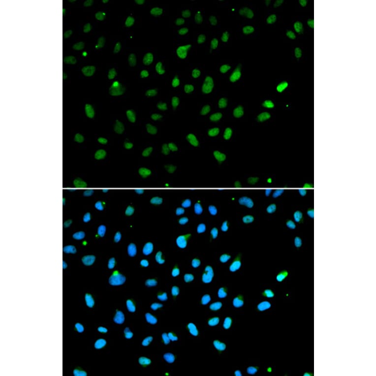 Immunofluorescence - SMARCA4 Antibody from Signalway Antibody (32608) - Antibodies.com