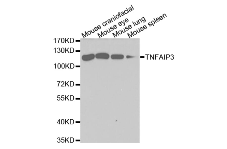 Western blot - TNFAIP3 Antibody from Signalway Antibody (32613) - Antibodies.com