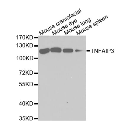 Western blot - TNFAIP3 Antibody from Signalway Antibody (32613) - Antibodies.com