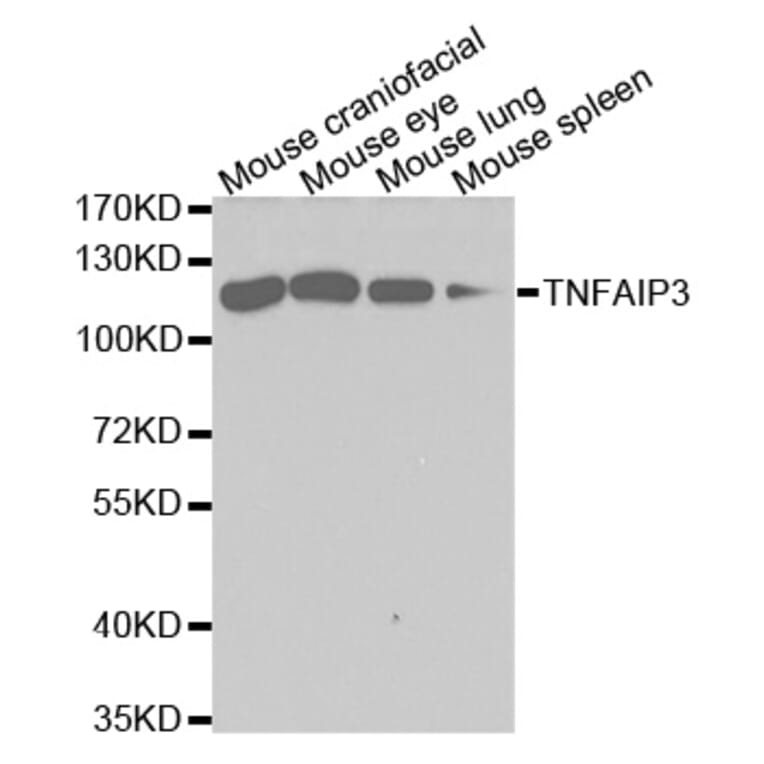 Western blot - TNFAIP3 Antibody from Signalway Antibody (32613) - Antibodies.com