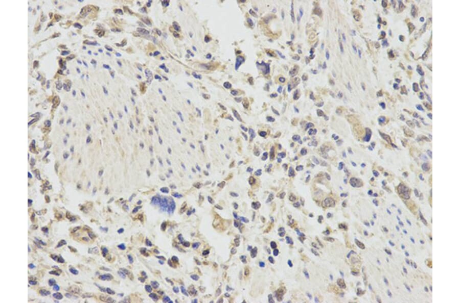 Immunohistochemistry - TNFAIP3 Antibody from Signalway Antibody (32613) - Antibodies.com