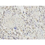 Immunohistochemistry - TNFAIP3 Antibody from Signalway Antibody (32613) - Antibodies.com