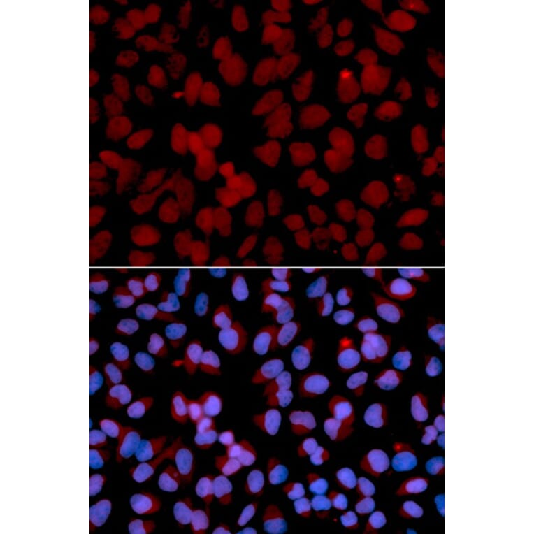 Immunofluorescence - TNFAIP3 Antibody from Signalway Antibody (32613) - Antibodies.com