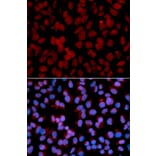 Immunofluorescence - TNFAIP3 Antibody from Signalway Antibody (32613) - Antibodies.com