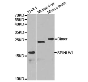 Western blot - SPINLW1 Antibody from Signalway Antibody (32626) - Antibodies.com