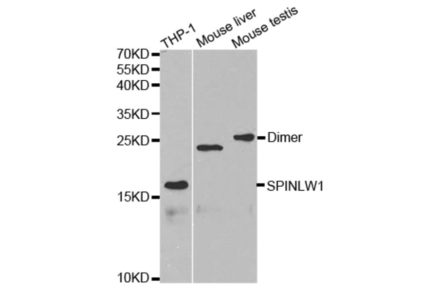 Western blot - SPINLW1 Antibody from Signalway Antibody (32626) - Antibodies.com