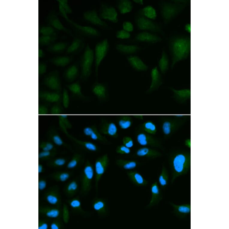 Immunofluorescence - SPINLW1 Antibody from Signalway Antibody (32626) - Antibodies.com