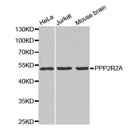 Western blot - PPP2R2A Antibody from Signalway Antibody (32650) - Antibodies.com
