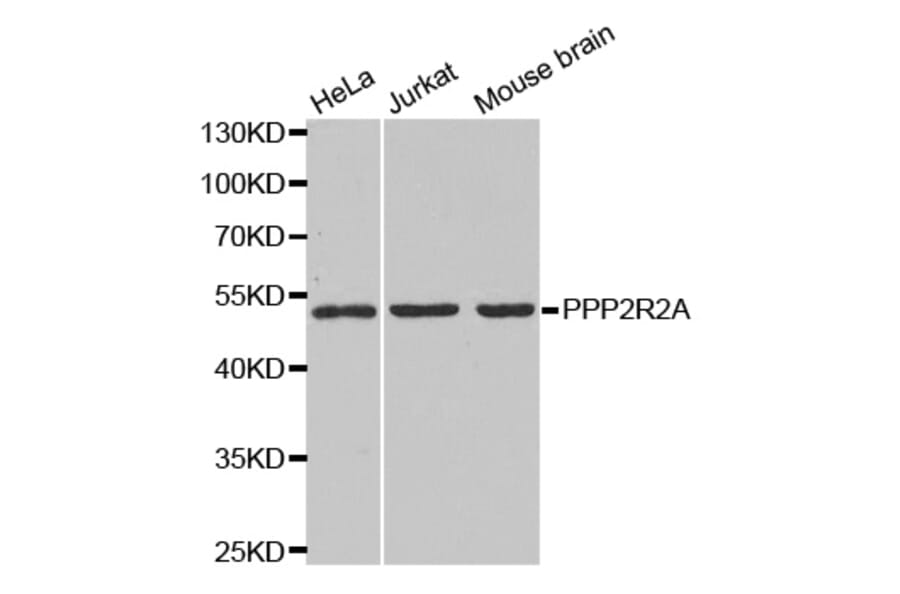 Western blot - PPP2R2A Antibody from Signalway Antibody (32650) - Antibodies.com