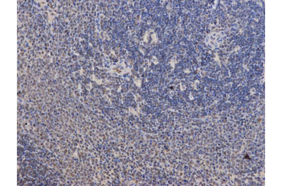 Immunohistochemistry - PPP2R2A Antibody from Signalway Antibody (32650) - Antibodies.com
