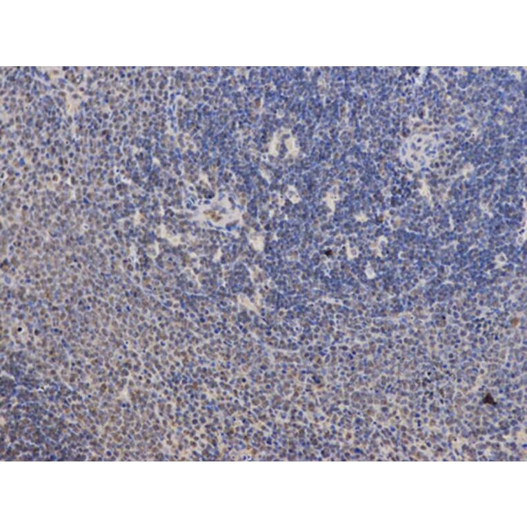 Immunohistochemistry - PPP2R2A Antibody from Signalway Antibody (32650) - Antibodies.com