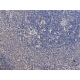 Immunohistochemistry - PPP2R2A Antibody from Signalway Antibody (32650) - Antibodies.com
