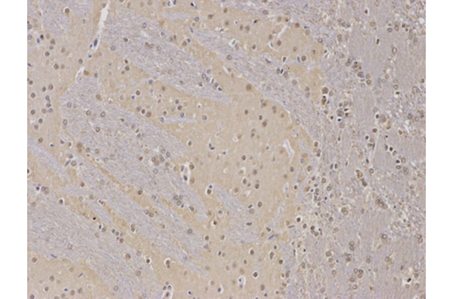 Immunohistochemistry - PPP2R2A Antibody from Signalway Antibody (32650) - Antibodies.com