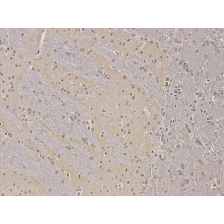 Immunohistochemistry - PPP2R2A Antibody from Signalway Antibody (32650) - Antibodies.com