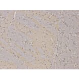 Immunohistochemistry - PPP2R2A Antibody from Signalway Antibody (32650) - Antibodies.com