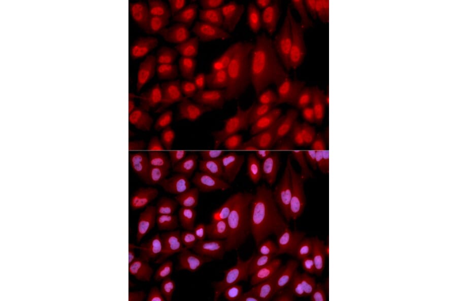 Immunofluorescence - PPP2R2A Antibody from Signalway Antibody (32650) - Antibodies.com