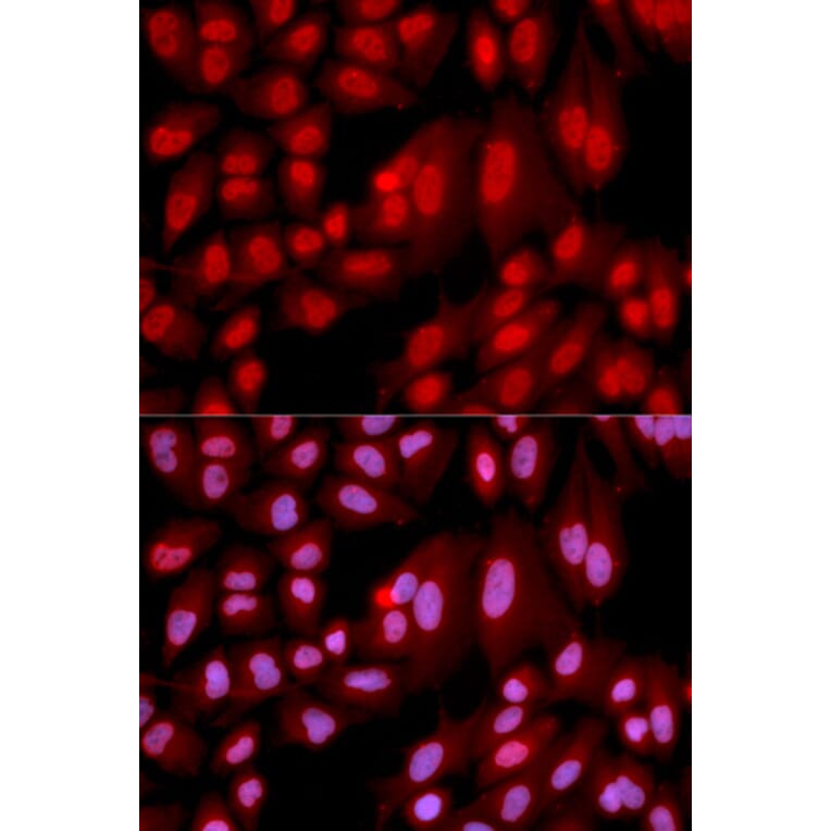 Immunofluorescence - PPP2R2A Antibody from Signalway Antibody (32650) - Antibodies.com