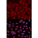 Immunofluorescence - RAPGEF3 Antibody from Signalway Antibody (32661) - Antibodies.com