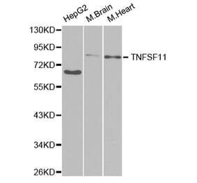 Western blot - TNFSF11 Antibody from Signalway Antibody (32708) - Antibodies.com