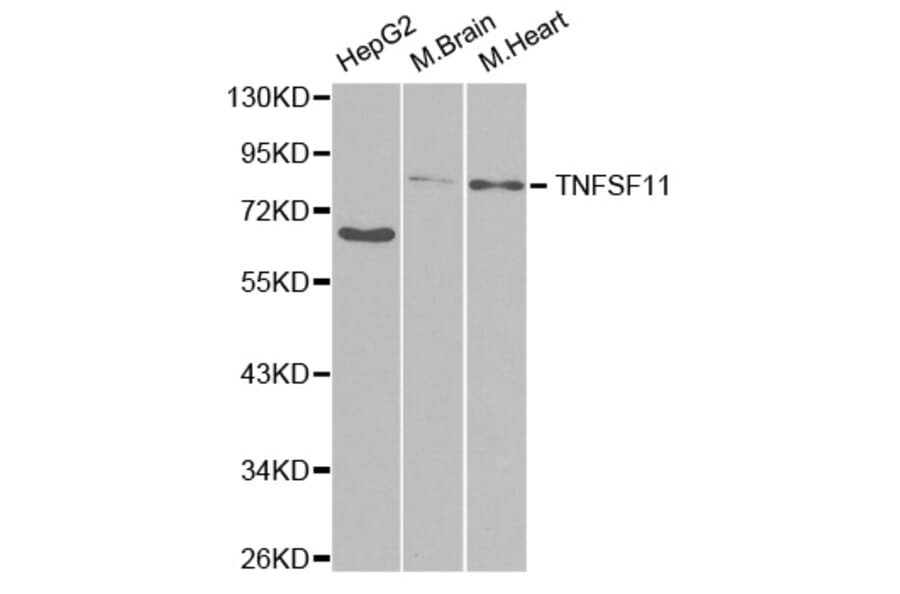 Western blot - TNFSF11 Antibody from Signalway Antibody (32708) - Antibodies.com