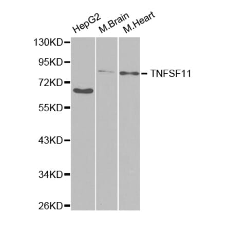 Western blot - TNFSF11 Antibody from Signalway Antibody (32708) - Antibodies.com