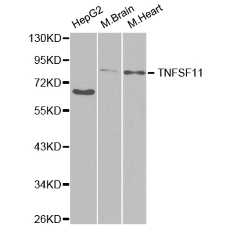 Western blot - TNFSF11 Antibody from Signalway Antibody (32708) - Antibodies.com