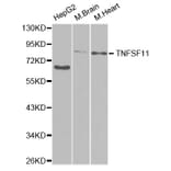 Western blot - TNFSF11 Antibody from Signalway Antibody (32708) - Antibodies.com