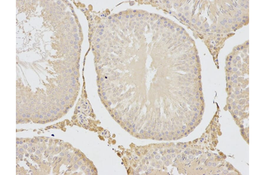Immunohistochemistry - TNFSF11 Antibody from Signalway Antibody (32708) - Antibodies.com