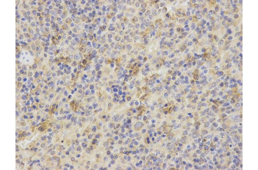 Immunohistochemistry - TNFSF11 Antibody from Signalway Antibody (32708) - Antibodies.com