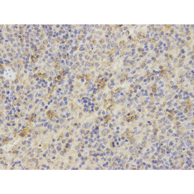 Immunohistochemistry - TNFSF11 Antibody from Signalway Antibody (32708) - Antibodies.com