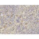 Immunohistochemistry - TNFSF11 Antibody from Signalway Antibody (32708) - Antibodies.com