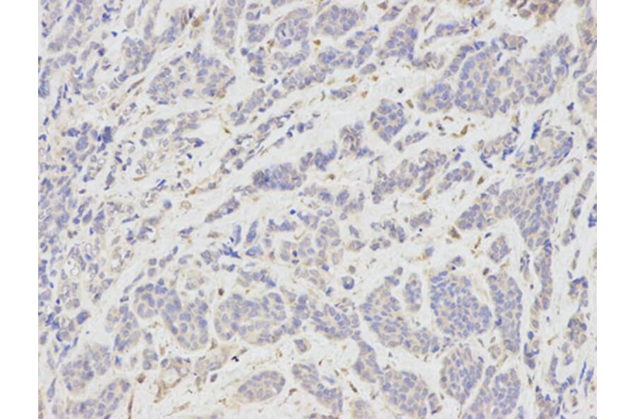 Immunohistochemistry - TNFSF11 Antibody from Signalway Antibody (32708) - Antibodies.com
