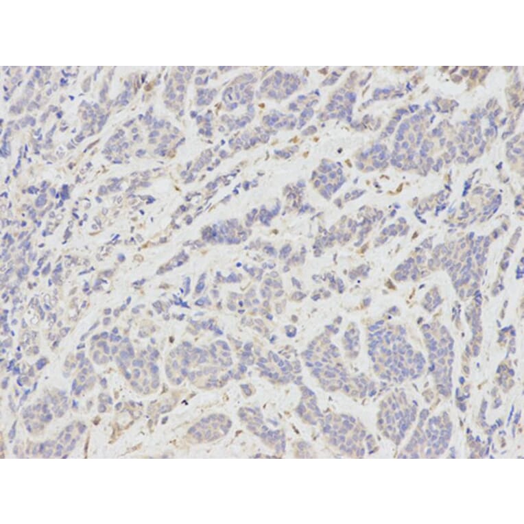 Immunohistochemistry - TNFSF11 Antibody from Signalway Antibody (32708) - Antibodies.com