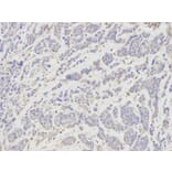 Immunohistochemistry - TNFSF11 Antibody from Signalway Antibody (32708) - Antibodies.com